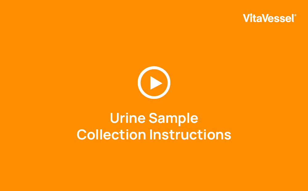 Urine Sample Collection