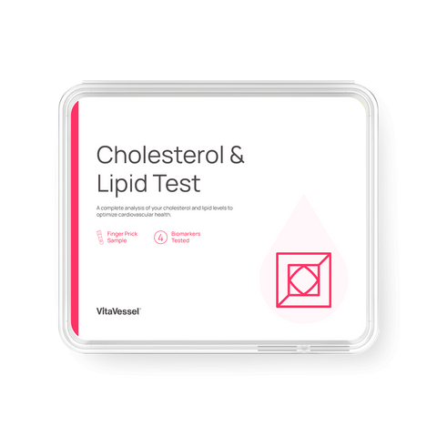 Cholesterol and Lipid Test